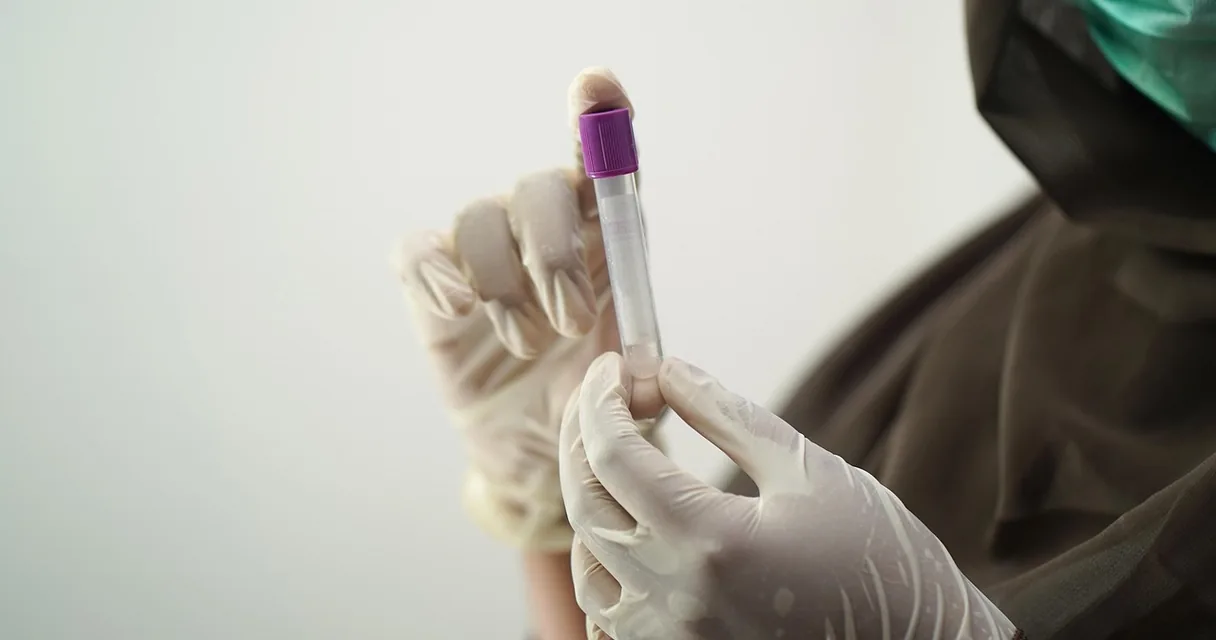 Tubo de coleta de sangue em laboratório de análises